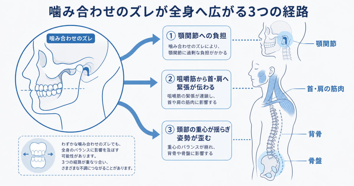 噛み合わせのズレが全身に広がる仕組み|顎関節・筋肉・姿勢への3大波及