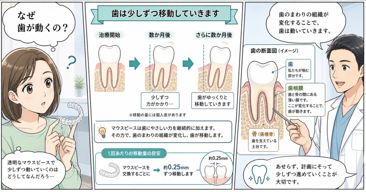 透明な矯正でなぜ歯が動く？0.25mm移動の仕組みと痛みを解説