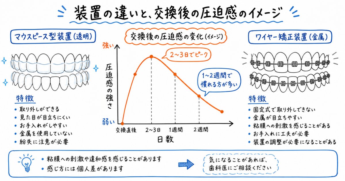 治療中に生じる痛みの仕組みとワイヤー矯正との違い