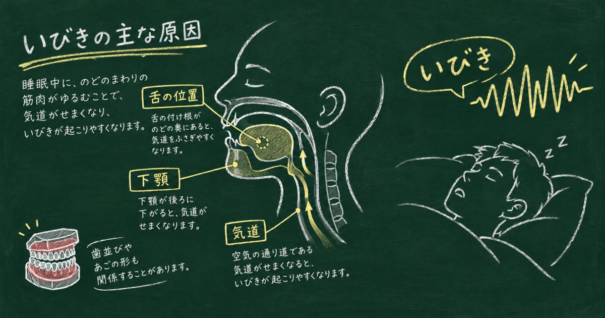 いびき・呼吸停止の指摘は噛み合わせが原因?歯科的な仕組みを解説